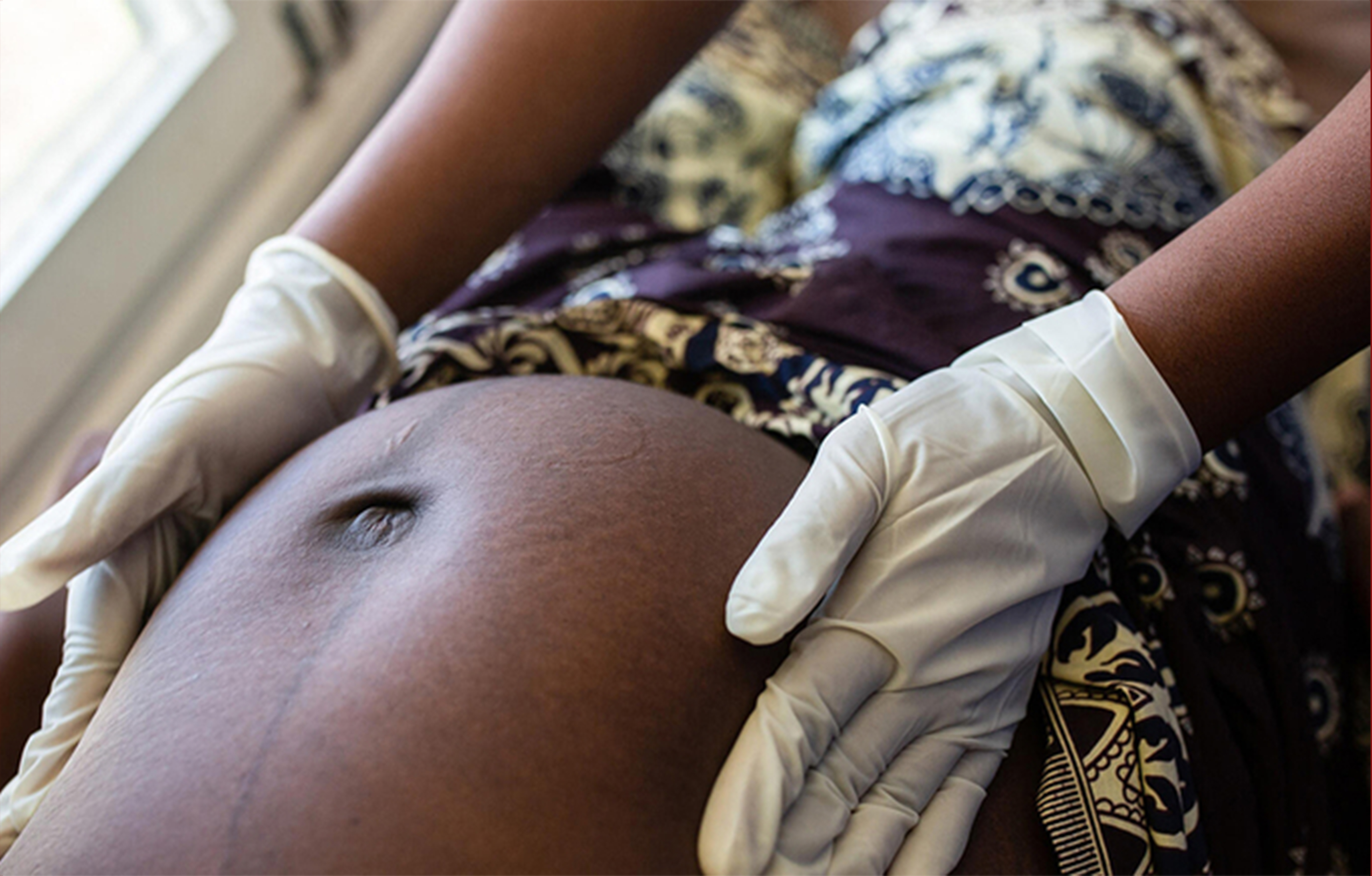 Pour la réduction de la fistule obstétricale en Haïti