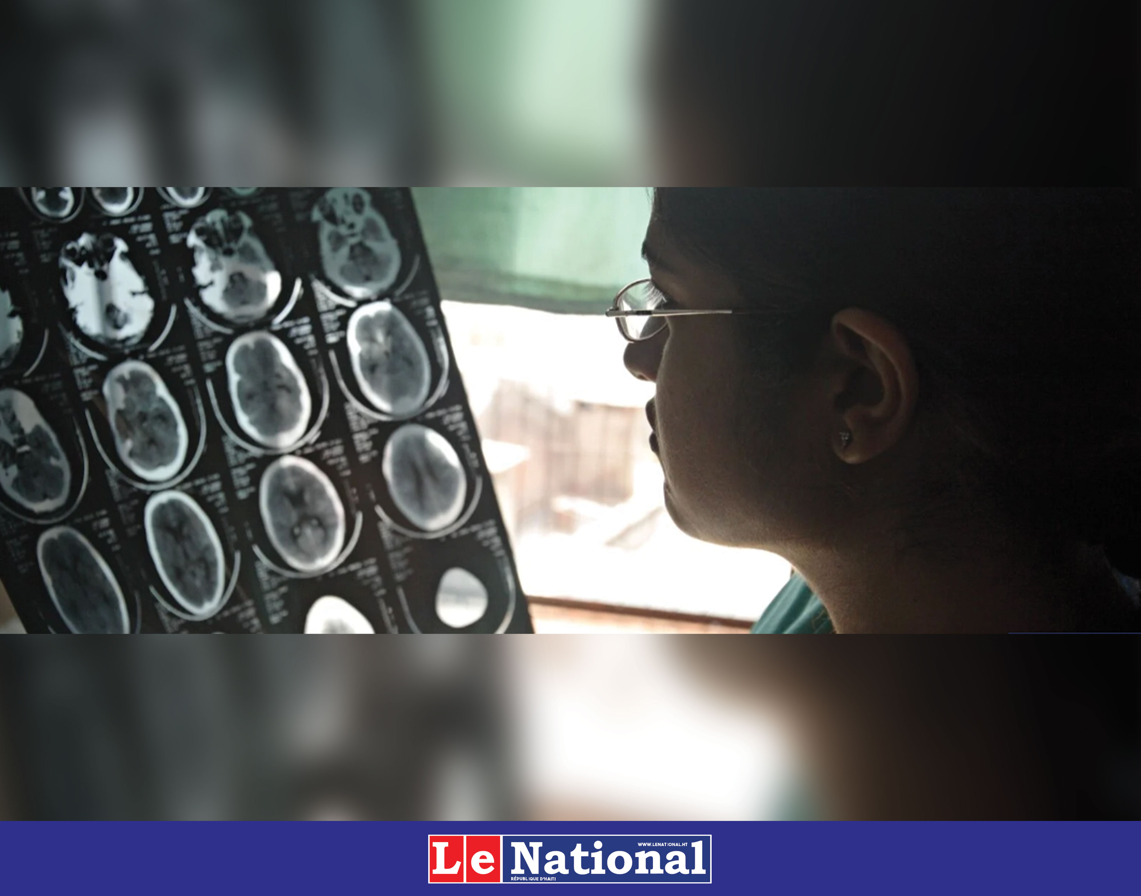 Agir de toute urgence pour améliorer les soins neurologiques et éviter 11 millions de décès chaque année
