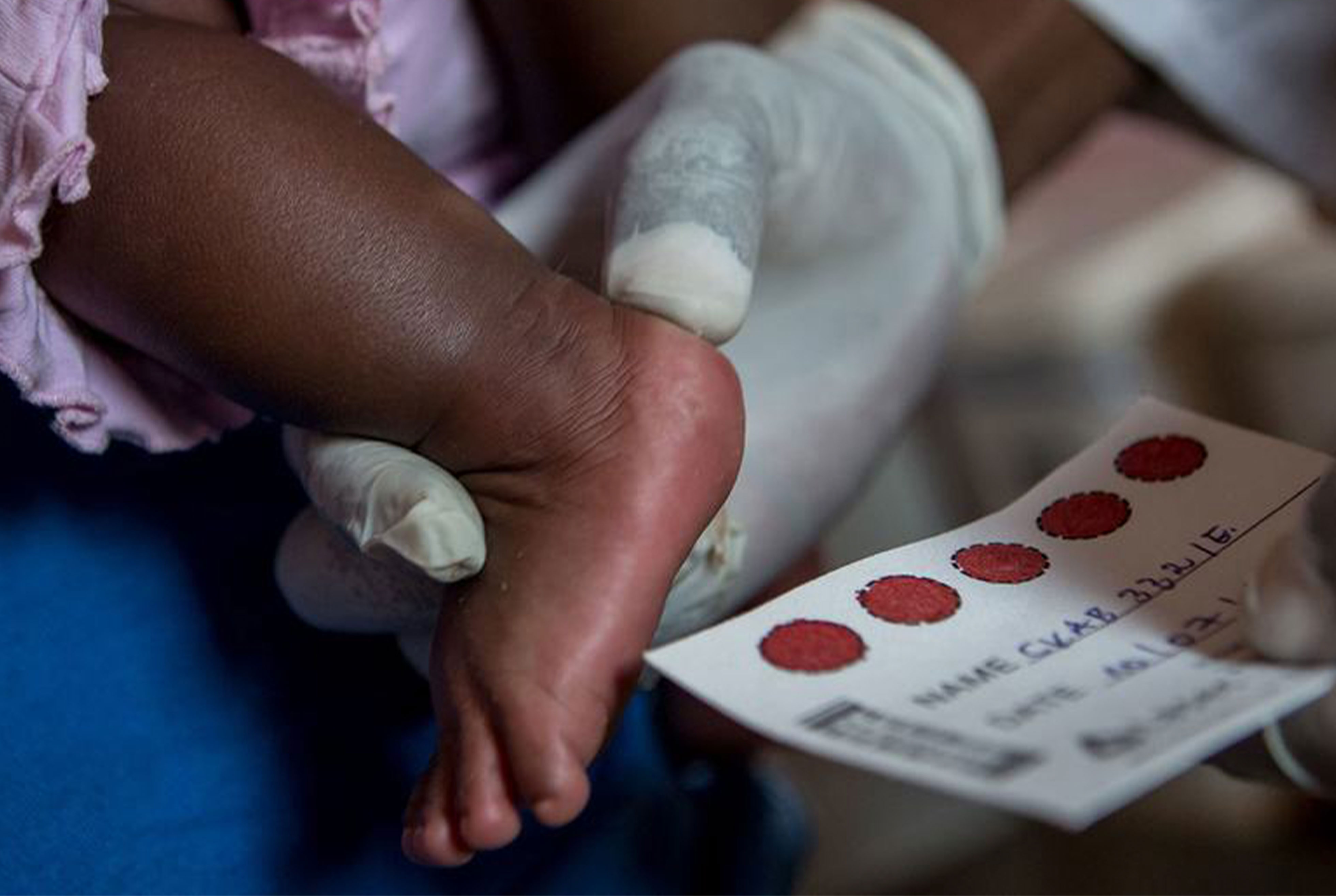 VIH : la riposte mondiale vacille au moment où la science promettait de changer la donne